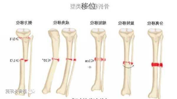 移位-第1张图片-七天装修网