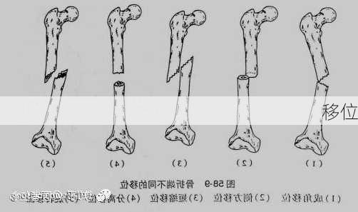 移位-第2张图片-七天装修网